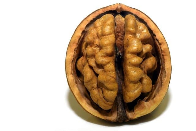 A close up of a brain